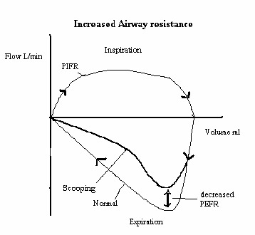 Flow Volume Chart